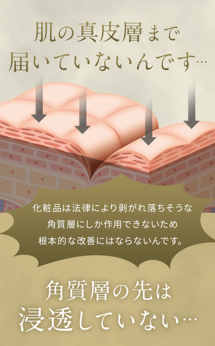 Siwaleap (シワリープ)